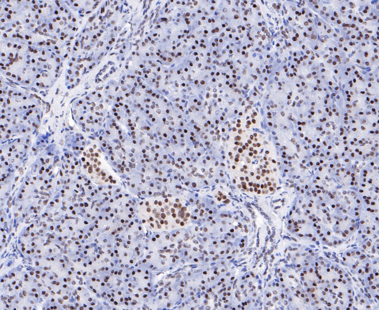 EWSR1 Antibody (MA5-34868)