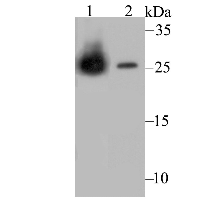 Carbonic Anhydrase II Antibody (MA5-34925)