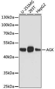 AGK Antibody in Western Blot (WB)