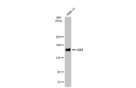Gli1 Antibody in Western Blot (WB)