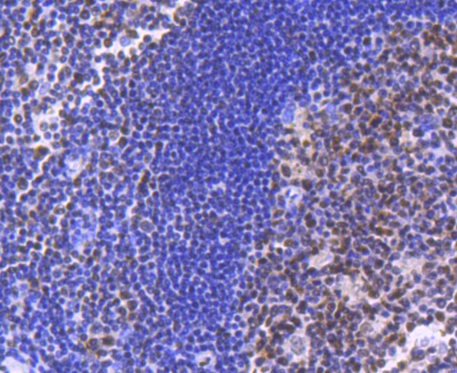 BRG1 Antibody in Immunohistochemistry (Paraffin) (IHC (P))