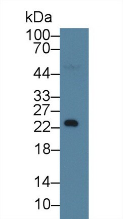 RBP4 Antibody in Western Blot (WB)