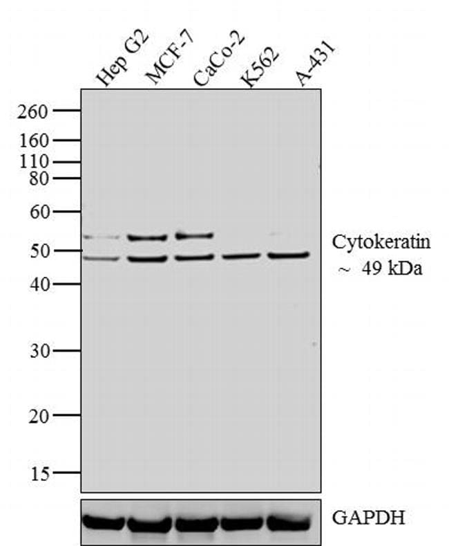 Cytokeratin HMW Antibody in Western Blot (WB)
