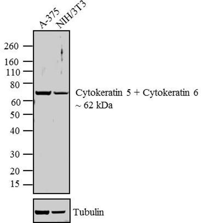 Cytokeratin 5 6 Antibody Ma5