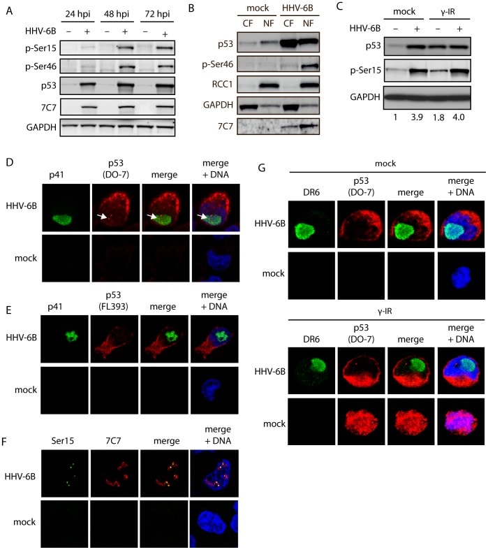 p53 Antibody (Monoclonal, DO-7)