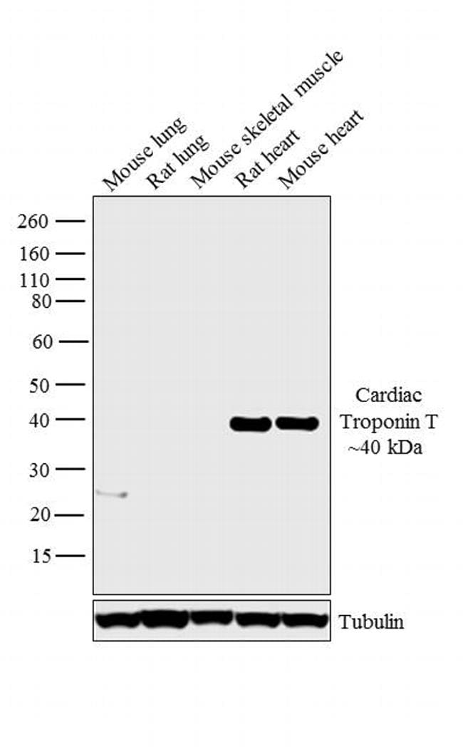 Cardiac Troponin T Antibody