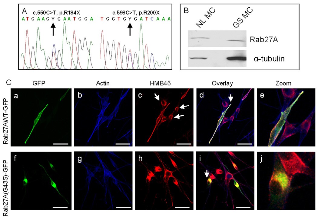 PMEL Antibody (Monoclonal, HMB45)