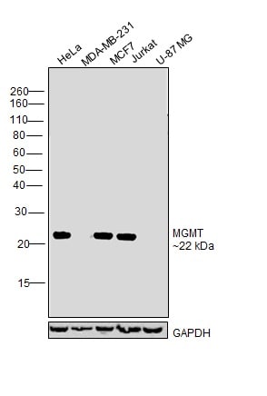 MGMT Antibody in Western Blot (WB)