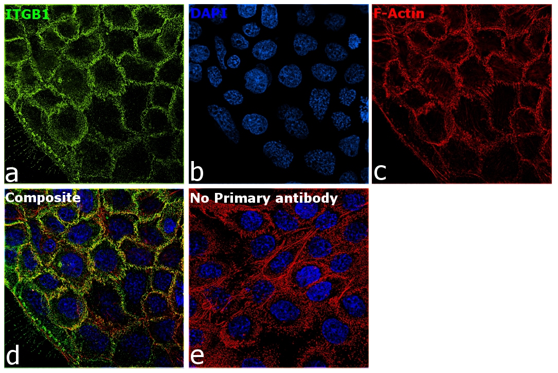 ITGB1 Antibody (MA5-13658)