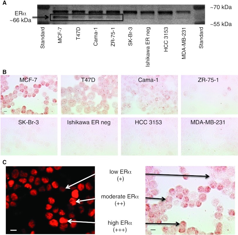 significant statistically ratio t Receptor alpha Antibody (Monoclonal, SP1) Estrogen