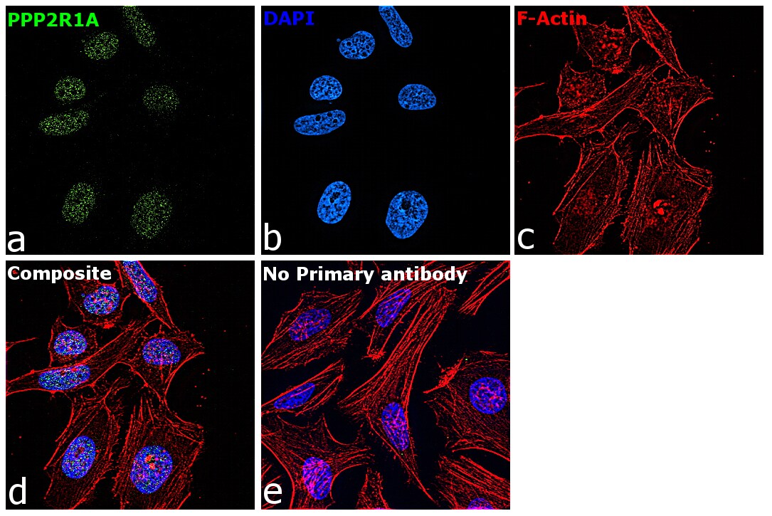 PPP2R1A Antibody in Immunocytochemistry (ICC/IF)