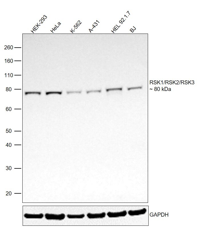 RSK1/RSK2/RSK3 Antibody (MA5-15040)