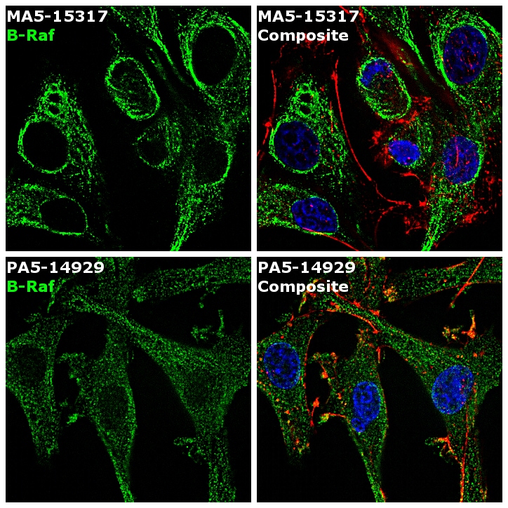 B-Raf Antibody (MA5-15317)