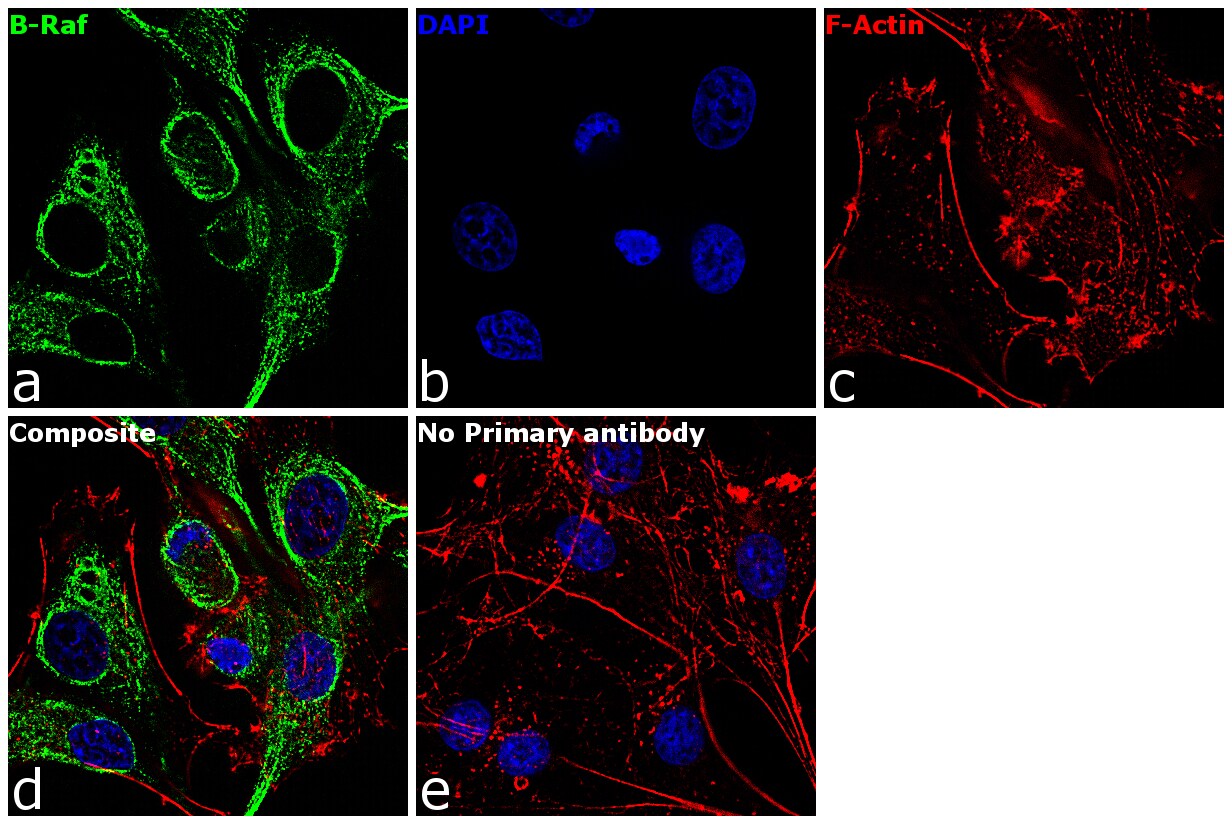 B-Raf Antibody (MA5-15317)