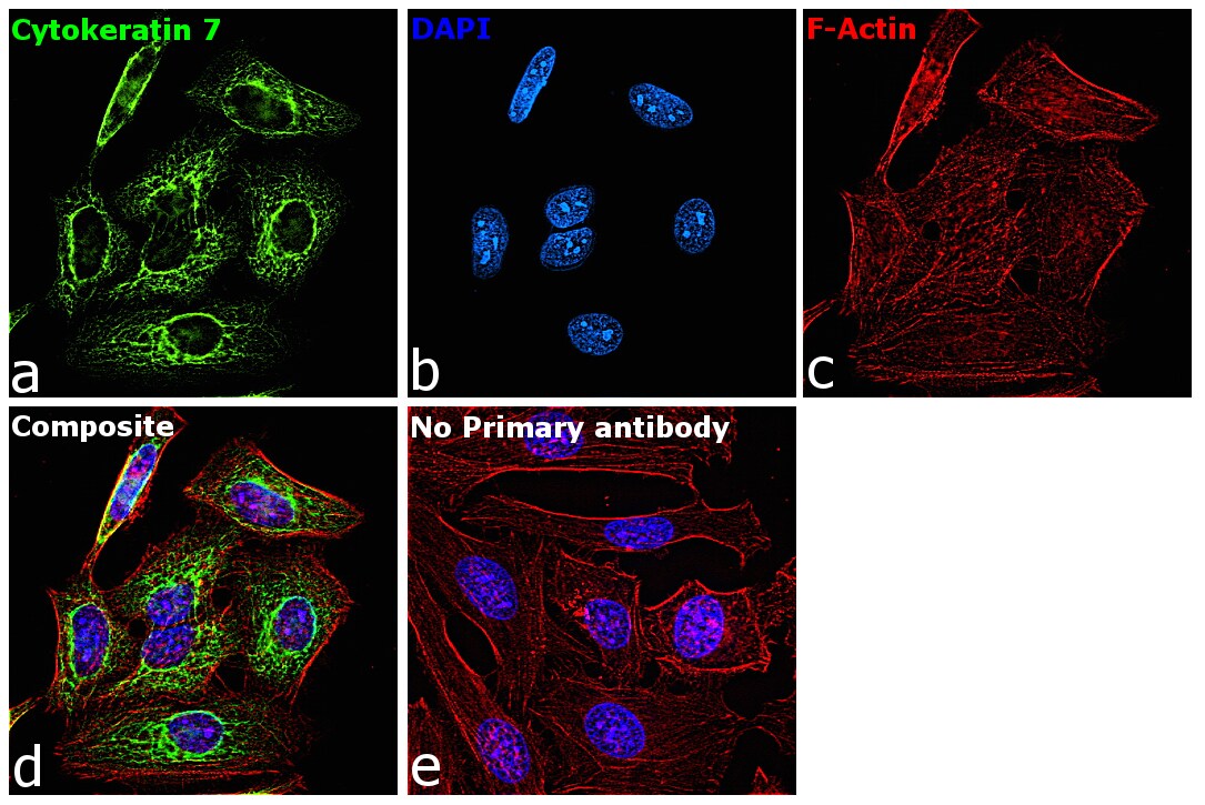 Cytokeratin 7 Antibody Ma5 15604