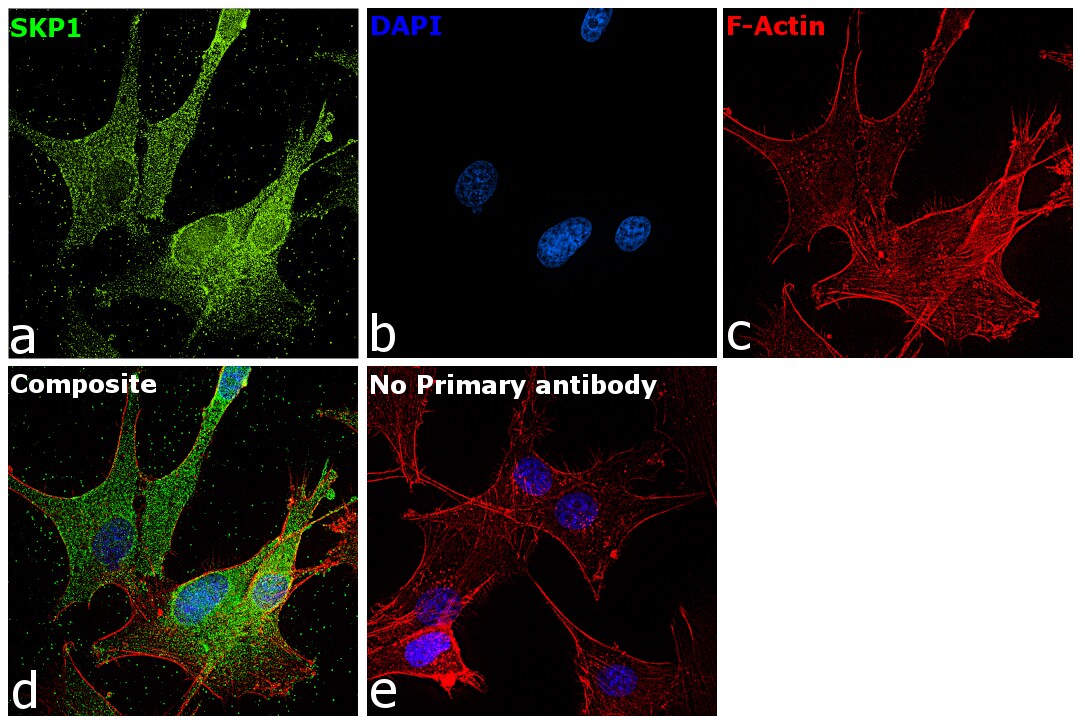 Skp1 Antibody (ma5-17174)