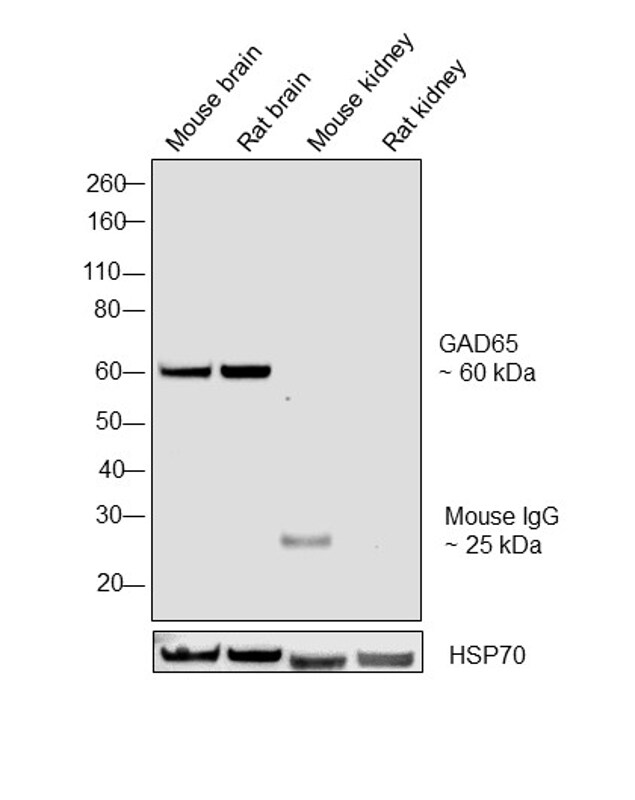 gad65-antibody-ma5-18053