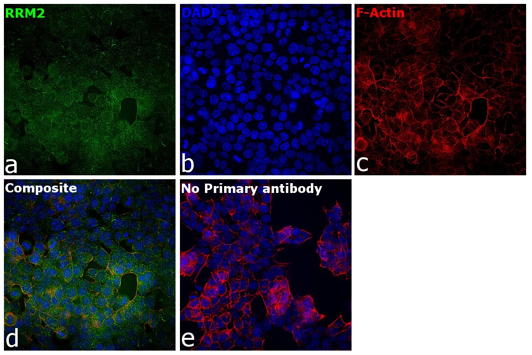 RRM2 Antibody in Immunocytochemistry (ICC/IF)