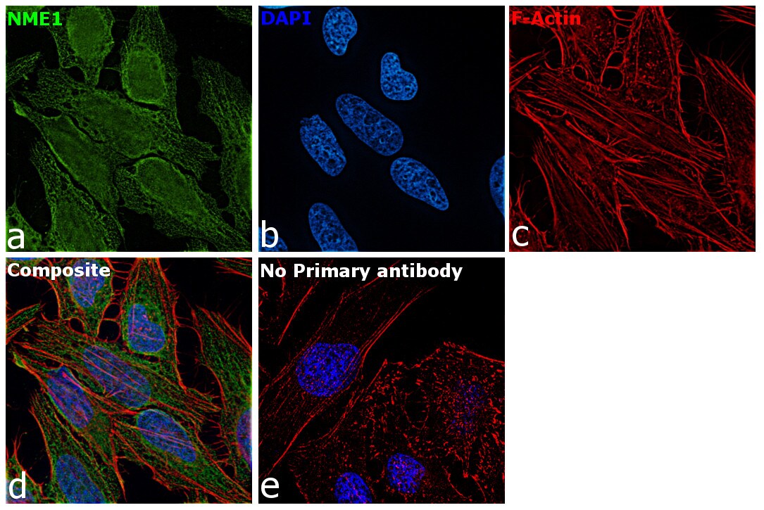 NME1 Antibody (MA5-30707)