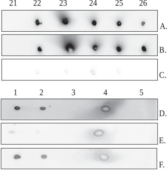 MBL2 Antibody in Dot Blot (DB)