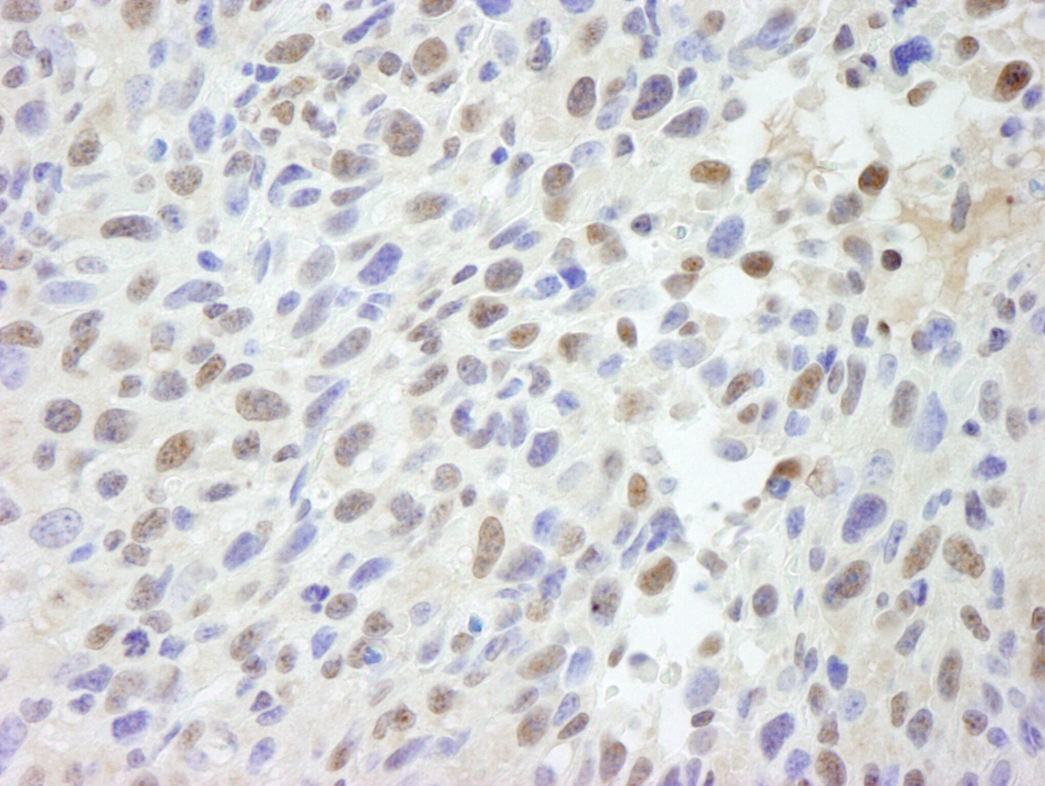 MED12 Antibody (IHC-00180-T)