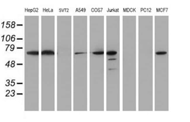 METT10D Antibody in Western Blot (WB)