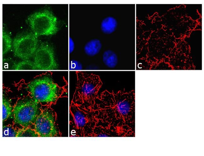 Apolipoprotein B Antibody (MIA1606)