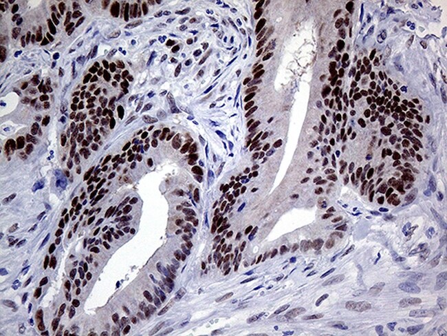 MLH1 Antibody (CF810261)