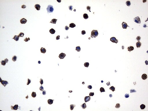 MME Antibody in Immunohistochemistry (Paraffin) (IHC (P))