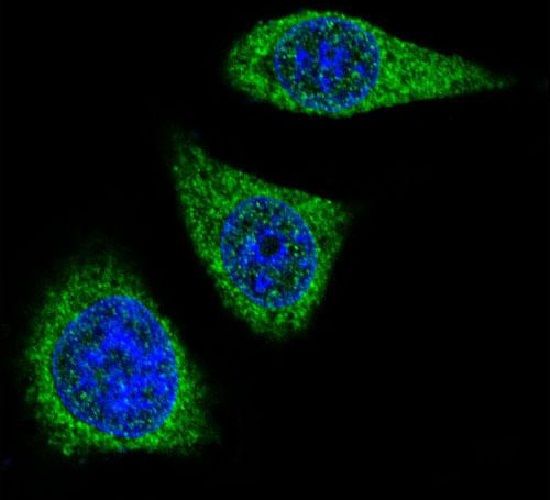 MMP7 Antibody (PA5-13197)