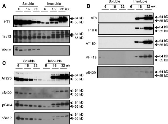 Tau Antibody (Monoclonal, BT2)