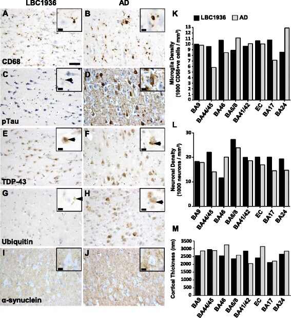 k-histogram Phospho Antibody (Ser202, Tau AT8) (Monoclonal, Thr205)