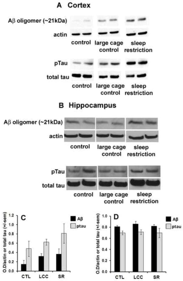 Phospho Tau Thr231 Antibody Monoclonal AT180 Phospho Tau Thr231 Antibody Monoclonal AT180
