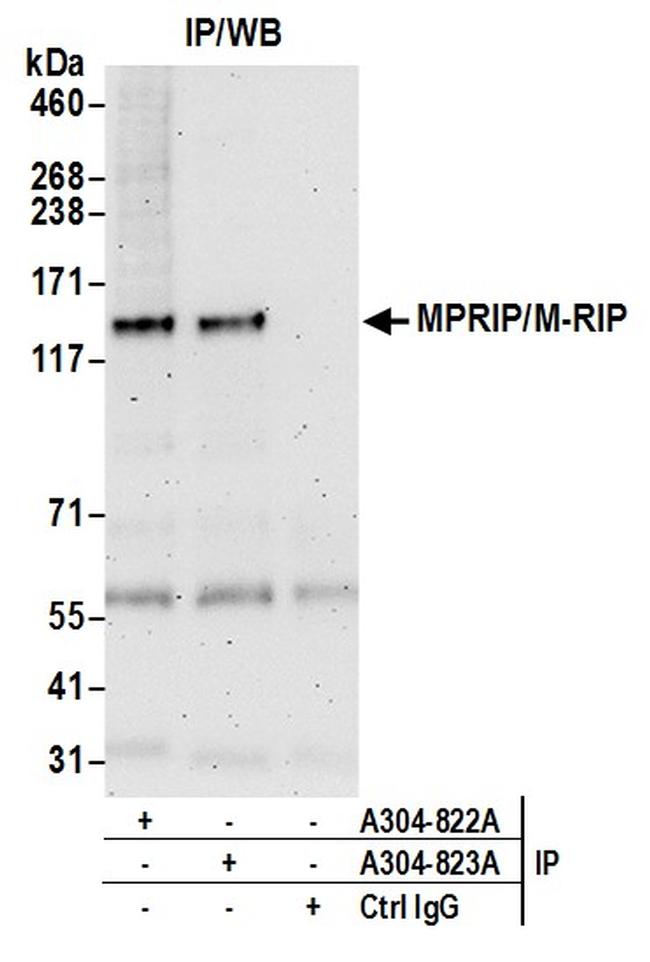 irip antibody irip antibody