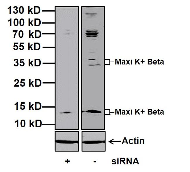 KCNMB1 Antibody