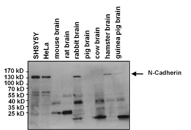 western blot ladder transferred but no proteins