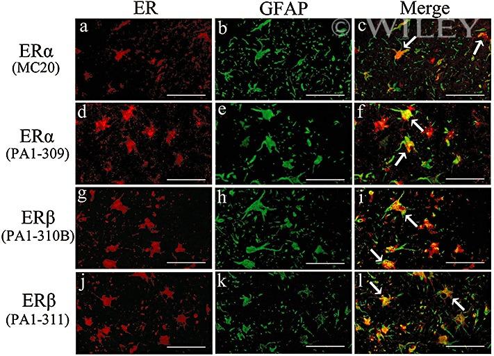 Estrogen Receptor beta Antibody in Immunohistochemistry (IHC)