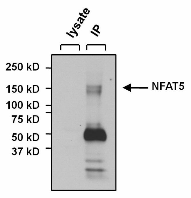 NFAT5 Antibody in Immunoprecipitation (IP)
