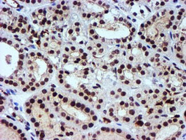NNMT Antibody in Immunohistochemistry (Paraffin) (IHC (P))