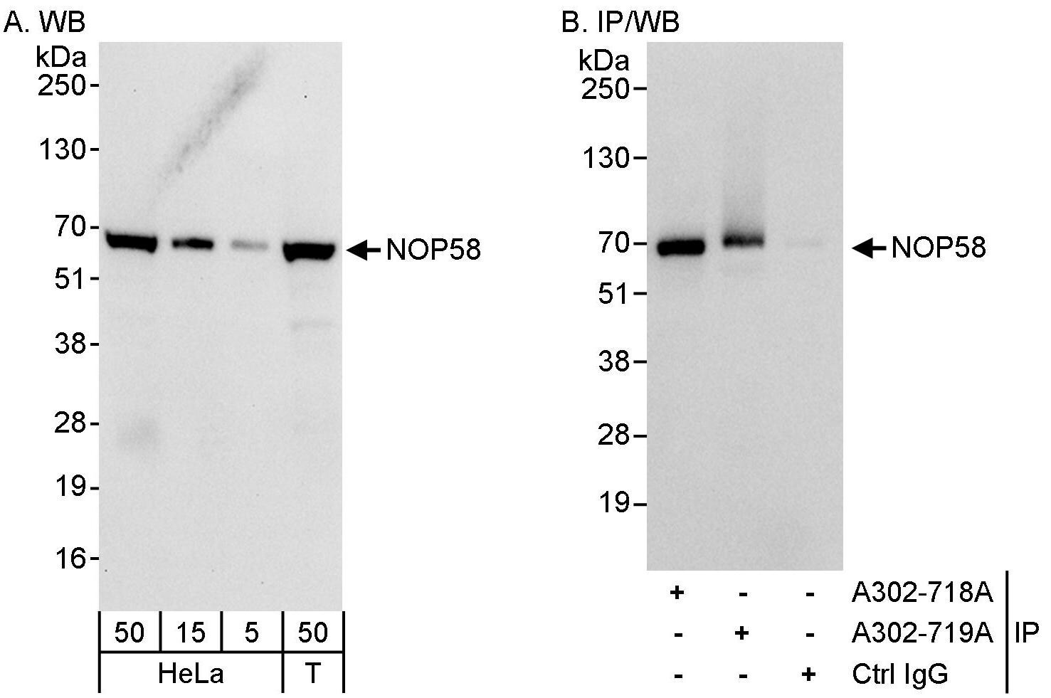 NOP58 Antibody (A302-719A)