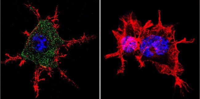 CHRNA1 Antibody in Immunocytochemistry (ICC/IF)