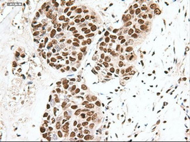 Notch1 Antibody in Immunohistochemistry (Paraffin) (IHC (P))