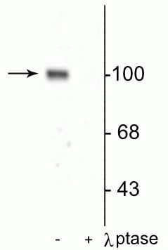 Phospho-GluR1 (Ser845) Antibody in Western Blot (WB)