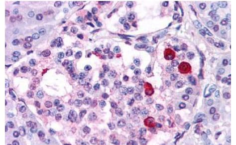 GIPR Antibody in Immunohistochemistry (Paraffin) (IHC (P))