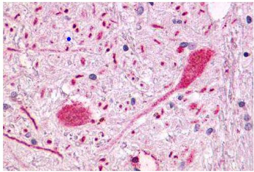 GPR55 Antibody in Immunohistochemistry (Paraffin) (IHC (P))