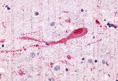 GPR55 Antibody in Immunohistochemistry (Paraffin) (IHC (P))