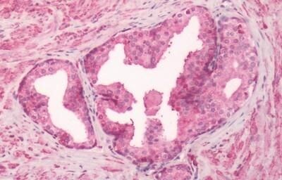 GPR55 Antibody in Immunohistochemistry (Paraffin) (IHC (P))