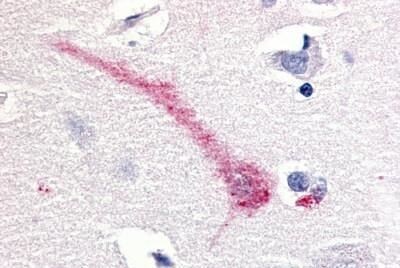 RON Antibody in Immunohistochemistry (Paraffin) (IHC (P))