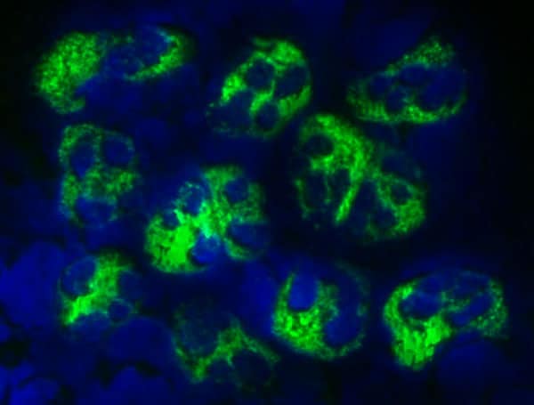 Cathelicidin Antibody in Immunocytochemistry (ICC/IF)