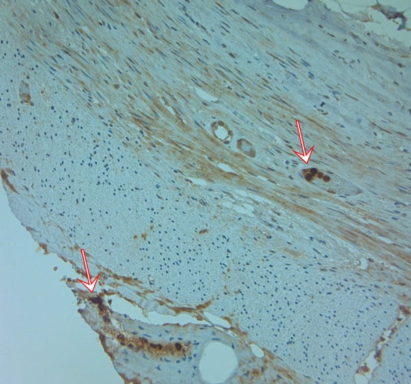 Cathelicidin Antibody in Immunohistochemistry (Paraffin) (IHC (P))